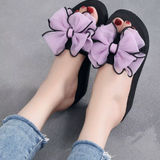 Jacinta® - Sandálias Ortopédicas ⏐Edição Premium