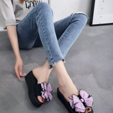 Jacinta® - Sandálias Ortopédicas ⏐Edição Premium